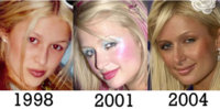 paris_hilton_three_nose_job.jpg