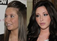 bristolpalinplasticsurgery3.jpg