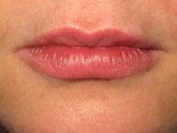 Lips Two.jpg