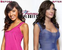 farrahabrahamlotsofplasticsurgery.jpg