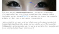 Me w double eyelid tape.jpg