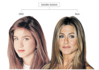 Botox-Jennifer-Aniston-001.jpg
