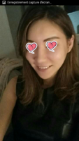 post op 3 months (2).png