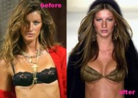 Gisele-Bundchen-Plastic-Surgery-Before-and-After-Photos-Nose-Job-and-Breast-Implants-2.jpg
