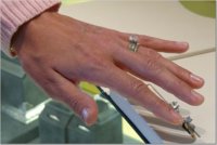 ringradiant4.jpg