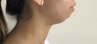 chin.png