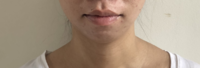 Chin2.png