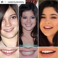 Celebrity And Veneers Purseforum