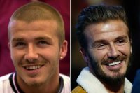 david-beckham-teeth.jpg