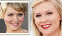 kirsten-dunst-plastic-surgery1.jpg