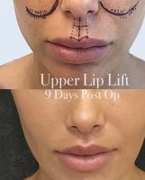 lips.jpg