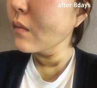 6_after.jpg 6_after.jpg