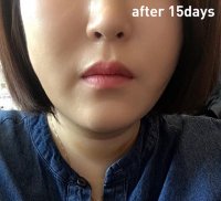 7_after.jpg 7_after.jpg