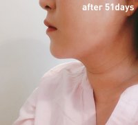 8_after.jpg 8_after.jpg