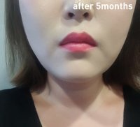 10_after.jpg 10_after.jpg