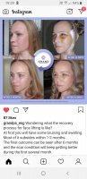 Screenshot_20190507-192939_Instagram.jpg