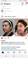 Screenshot_20190507-193151_Instagram.jpg