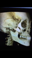 4A124B26-2592-49AA-A914-287CF682709B.png