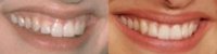 lipscloseup6sb.jpg