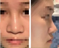 nose.jpg nose.jpg