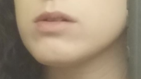 before2.png before2.png