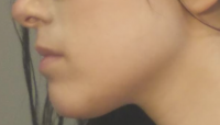 before3.png before3.png