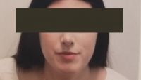 before4.png before4.png