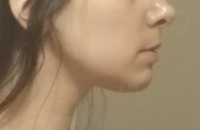 after4.png after4.png