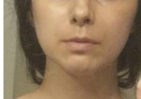 after5.png after5.png