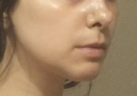 after6.png after6.png