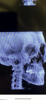 108CA49E-B880-4C18-9C60-B4A95BC2CBE0.png 108CA49E-B880-4C18-9C60-B4A95BC2CBE0.png