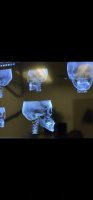 F1A4D3A9-5EBA-4B49-99AB-83C617E0A2D2.png F1A4D3A9-5EBA-4B49-99AB-83C617E0A2D2.png