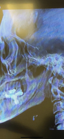B7270B5B-8223-43BE-8444-CC13A5180CFE.png B7270B5B-8223-43BE-8444-CC13A5180CFE.png
