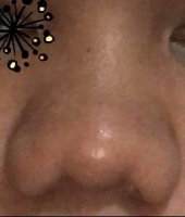 1nose.jpg 1nose.jpg