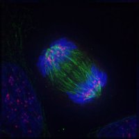 450px-Anaphase_IF.jpg