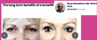 browlift.png
