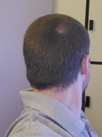 back of head6.png