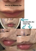 lips collage.jpg