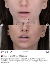 DrGaryNYC 5 weeks .jpg