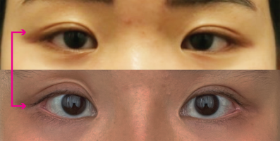 botched1.png