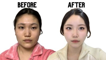 My Before after.JPG