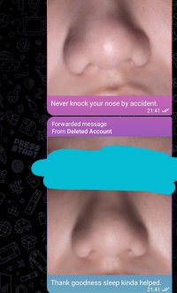 Nobody Nose.jpg Nobody Nose.jpg