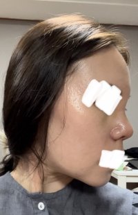 Cast Remove