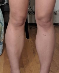 presurgery2019.jpg