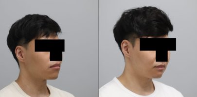 6 months BA 1.jpg