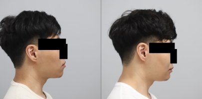 6 months BA 2.jpg