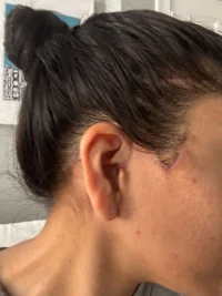 right scar.webp