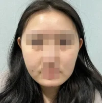 정인아 윤곽 후.webp 정인아 윤곽 후.webp