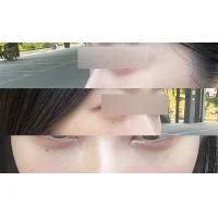 사본 -보정본.webp