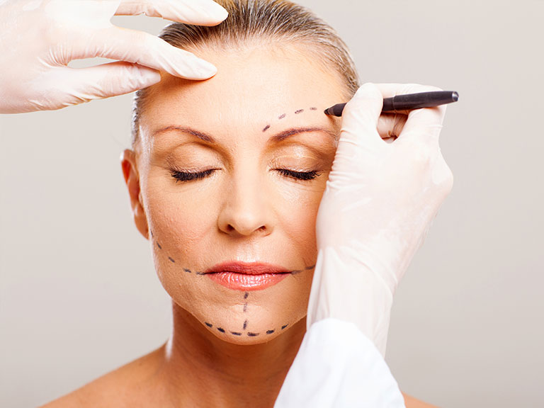 faceliftplasticsurgery.com.au